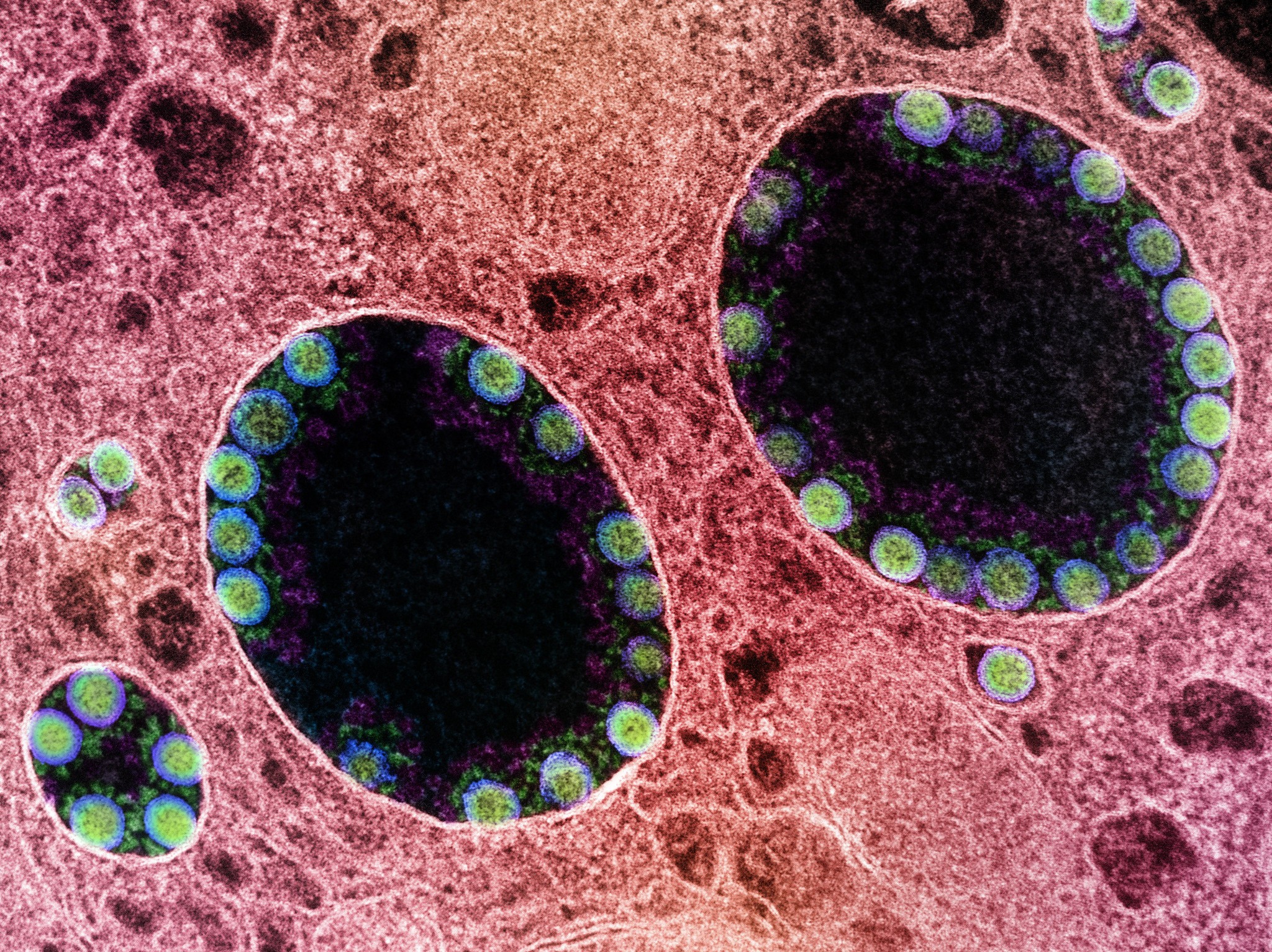 Electron micrograph of transmission of SARS-CoV-2 virus particles (in green) within the endosomes of a highly infectious nasal olfactory cell.  (Photo: NIAID)