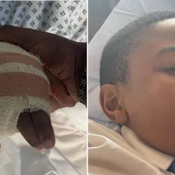 An 11-year-old boy lost his finger during a bullying episode in the UK