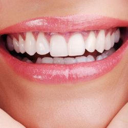 The shape of your teeth can say more about you than you think